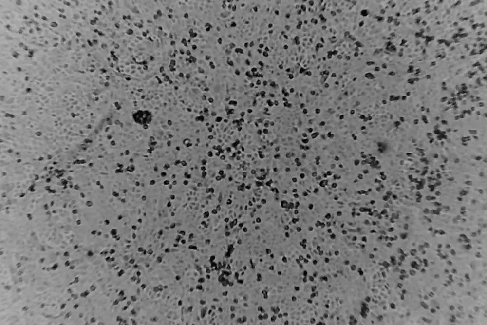 Coronavirus Aus