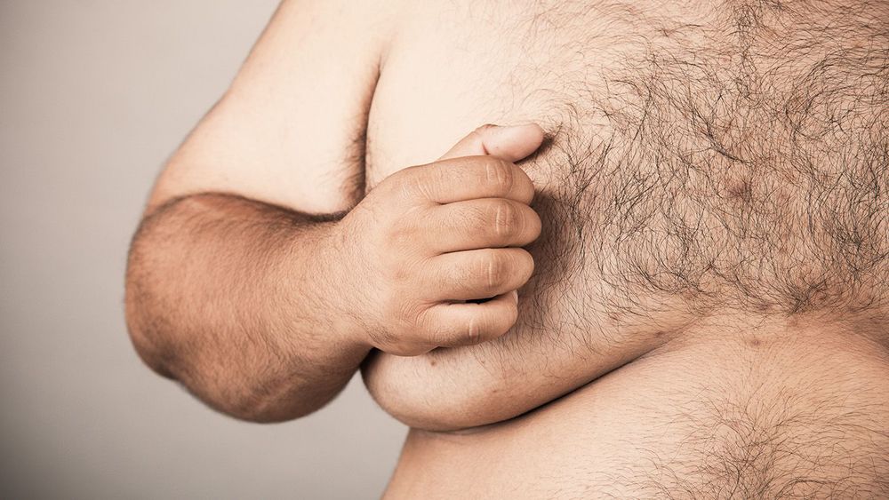 Fat men,Fat people who have a lot of body hair, fat skin, detail