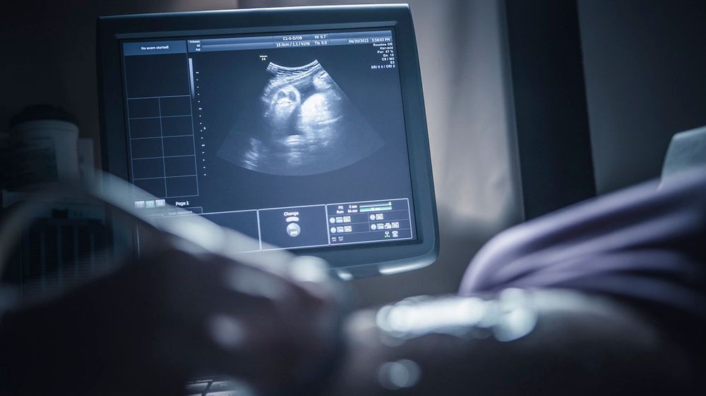 Pregnant woman having sonogram